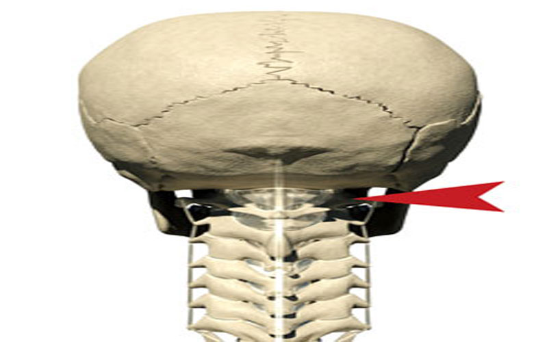 Fistula Treatment